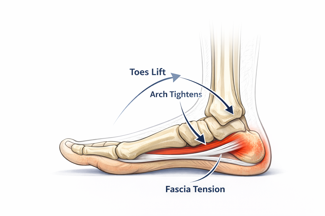 What Is Plantar Fasciitis and Why Does It Hurt Most in the Morning?