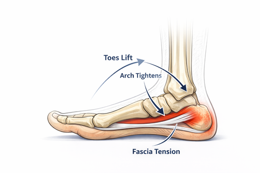 What Is Plantar Fasciitis and Why Does It Hurt Most in the Morning?